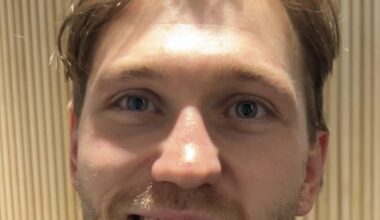 Frisk Asker, Sport | Christian (28) etter slåsskampen: – Sjokkert om jeg blir straffet - Budstikka