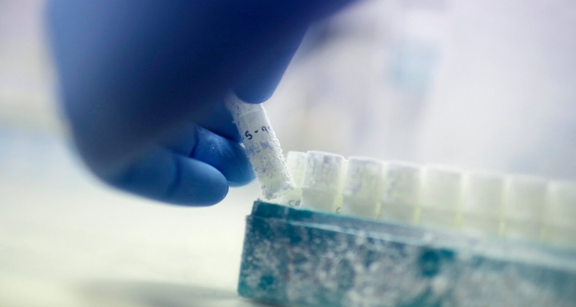 Sæd, Sæddonasjon | 16 norske kvinner har fått barn med dansk sæddonor med sjelden mutasjon som øker kreftfaren