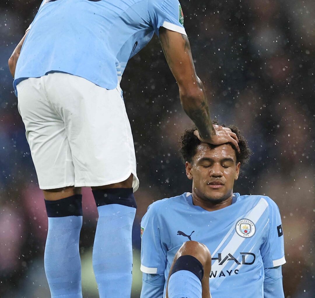 Oscar Bobb skadet i Ligacupen-kampen mot Newcastle