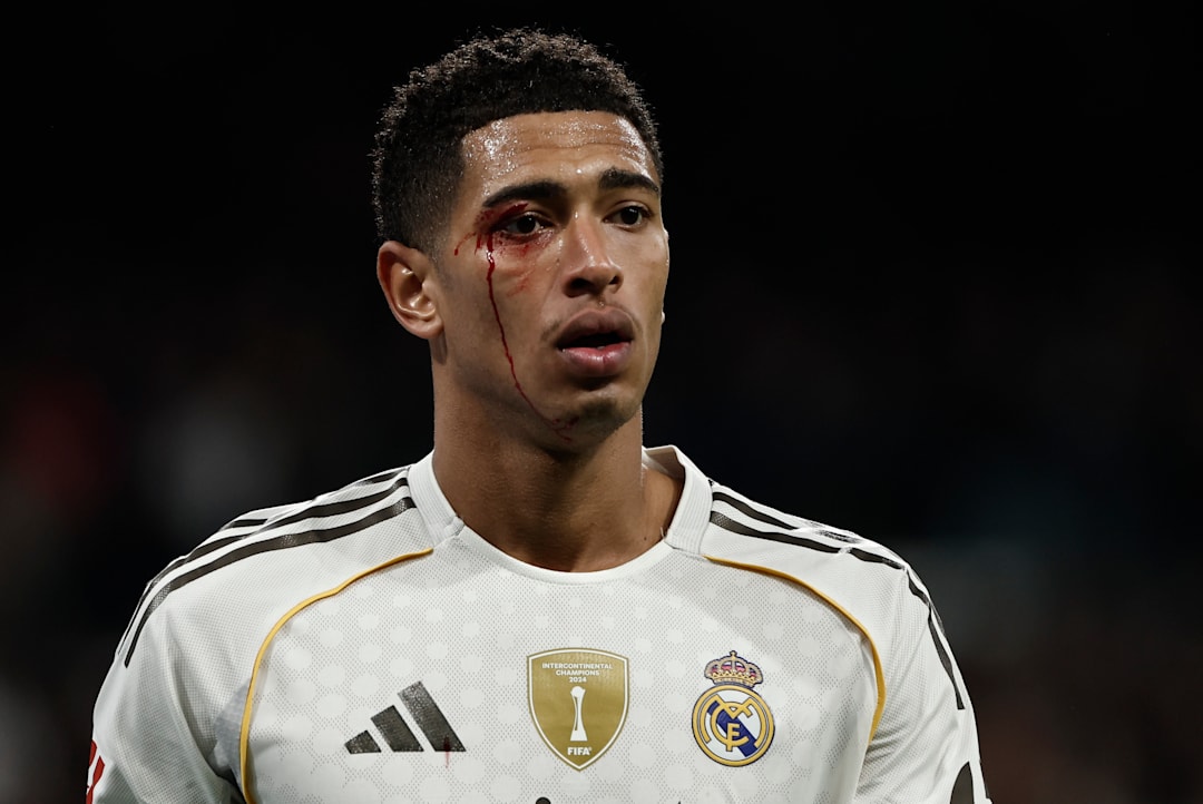 Kortene haglet i sjelden Real Madrid-smell – ikke skjedd på åtte år