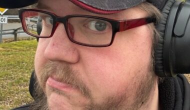 Fem om dagen - fikk hjerneblødning