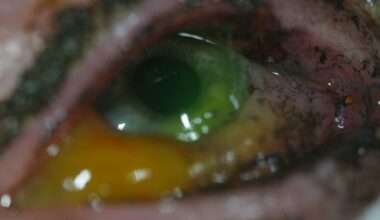 Øyeskader, Fyrverkeri | Ti personer fikk øyeskader fra fyrverkeri – ber om forbud