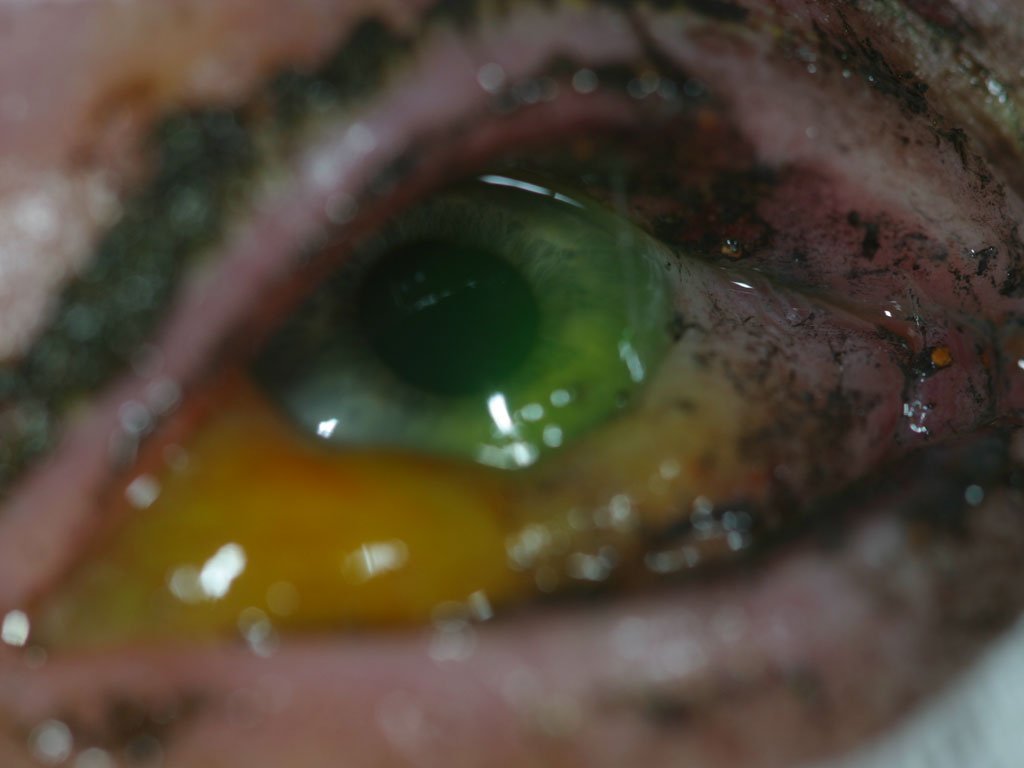 Øyeskader, Fyrverkeri | Ti personer fikk øyeskader fra fyrverkeri – ber om forbud