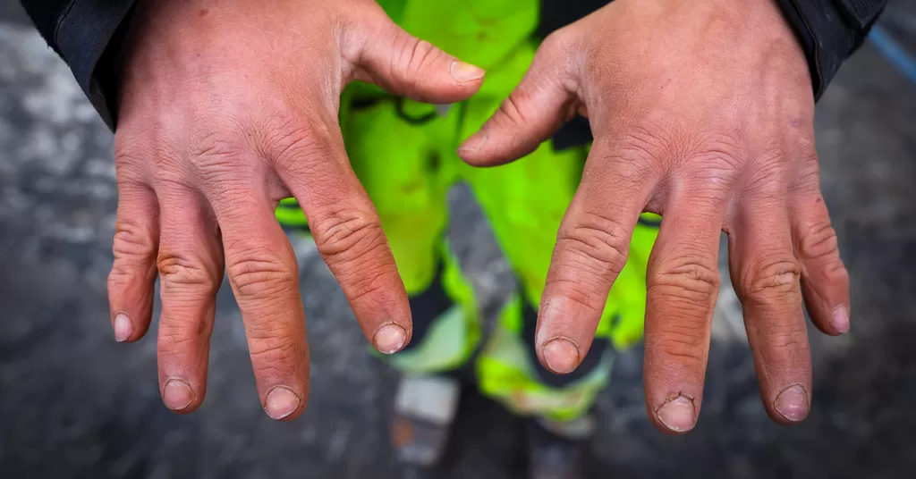 Sykdom truer 200.000 arbeidsfolk | FriFagbevegelse