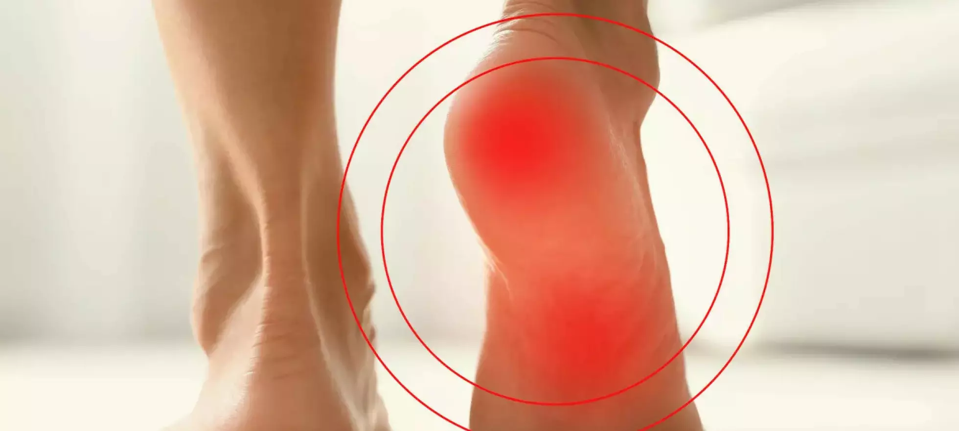 Plantar fascitt: Smertefri i superfart