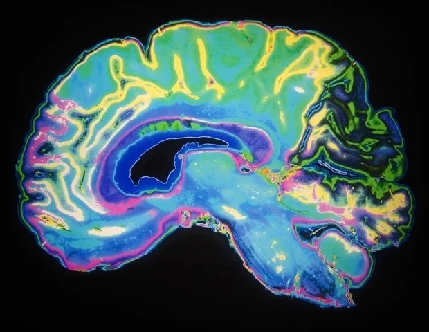 Le traitement précoce des tumeurs cérébrales à croissance lente peut aggraver la fonction cognitive