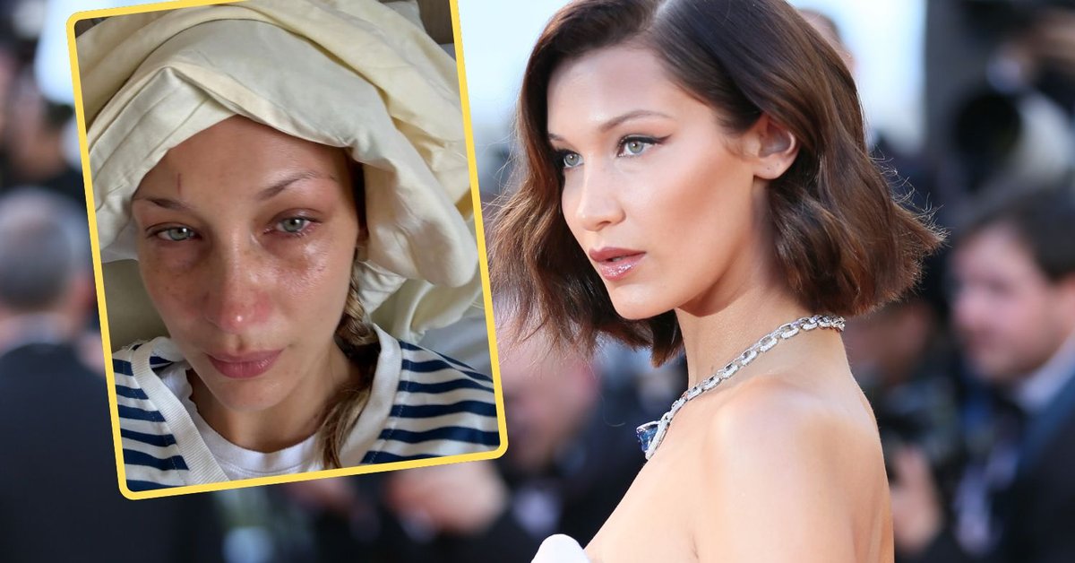 Zapłakana Bella Hadid w szpitalu. Modelka od 17 lat walczy z chorobą