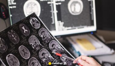 Po diagnozie pacjenci żyją średnio 10 lat. Choroba rozwija się w ukryciu