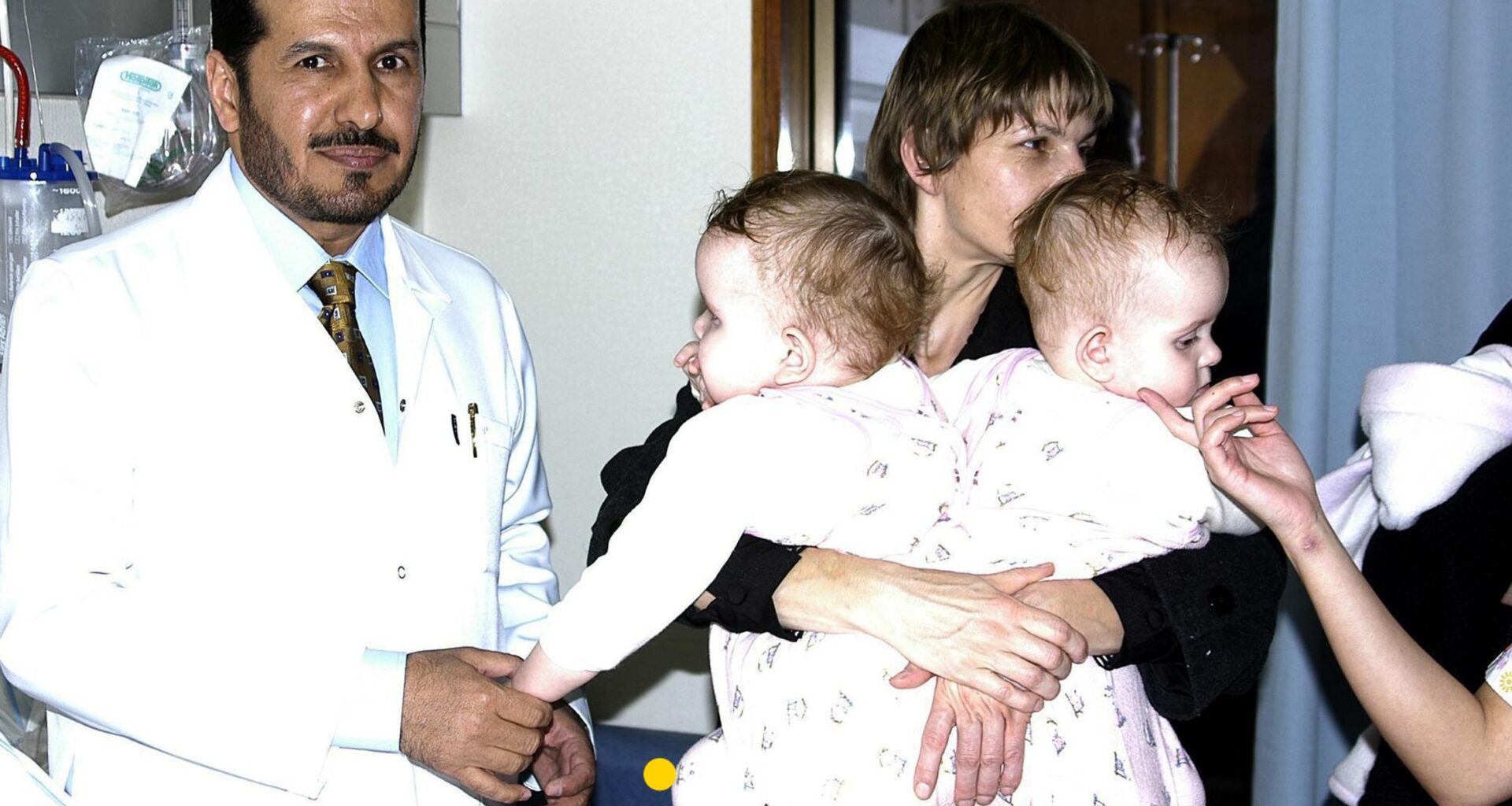 Bliźniaczki syjamskie z Janikowa po 20 latach od rozdzielenia