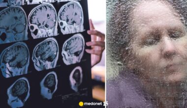 Choroba Alzheimera: jak zatrzymać wzrost liczby chorych w Polsce