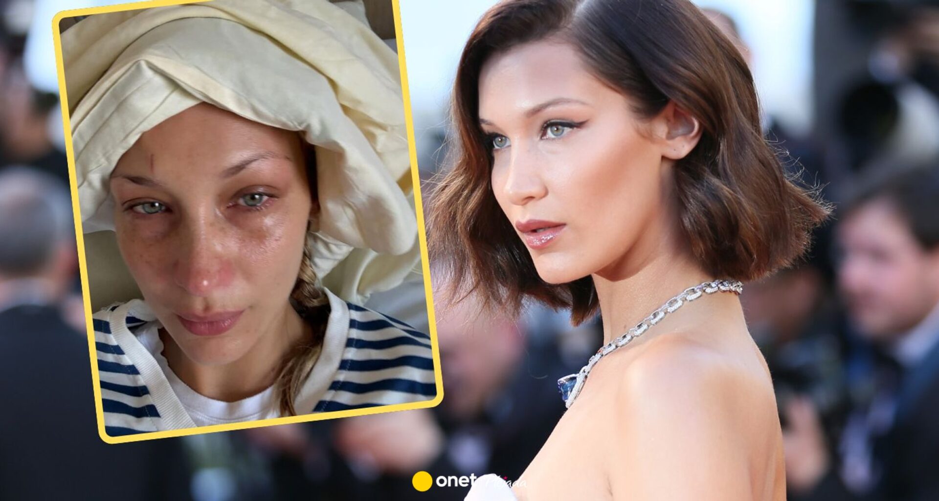 Bella Hadid ma nawrót choroby. Aniołek Victoria's Secret pokazał niepokojące zdjęcia