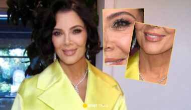 Tak naprawdę wygląda Kris Jenner po operacji. Internauci nie kryli zdziwienia