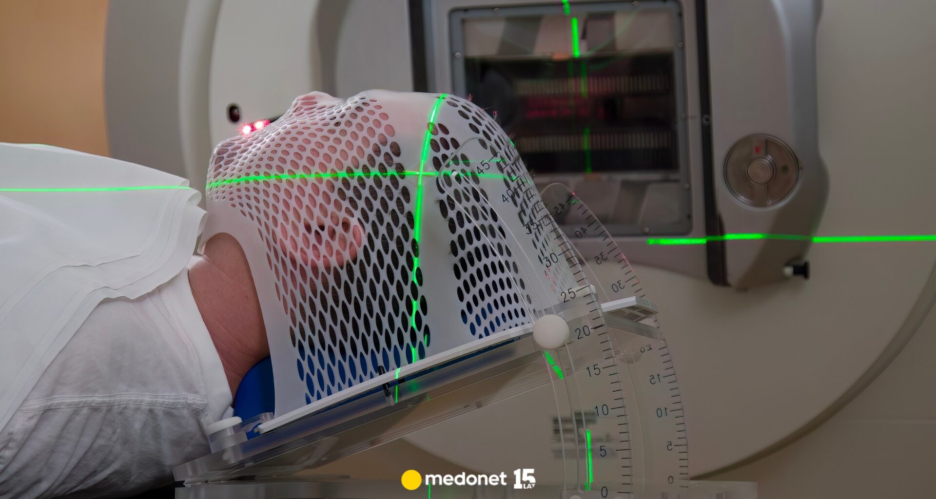 Mamy pierwszy lek na glejaka. To jeden z mniej rokujących nowotworów