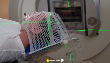 Mamy pierwszy lek na glejaka. To jeden z mniej rokujących nowotworów