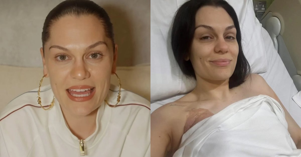 Jessie J walczy z rakiem. Do kolejnej operacji nie doszło. "Sprawa jest skomplikowana"