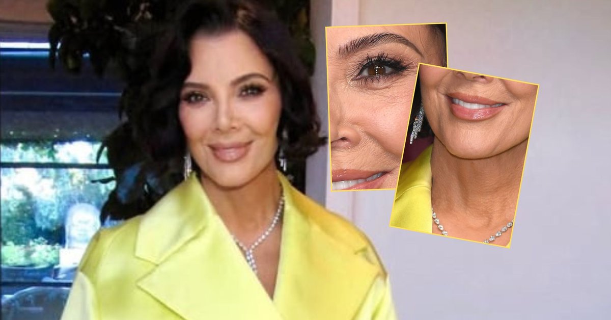 Tak naprawdę wygląda Kris Jenner po liftingu. Są zdjęcia bez filtrów. "Wreszcie ktoś to pokazał!"