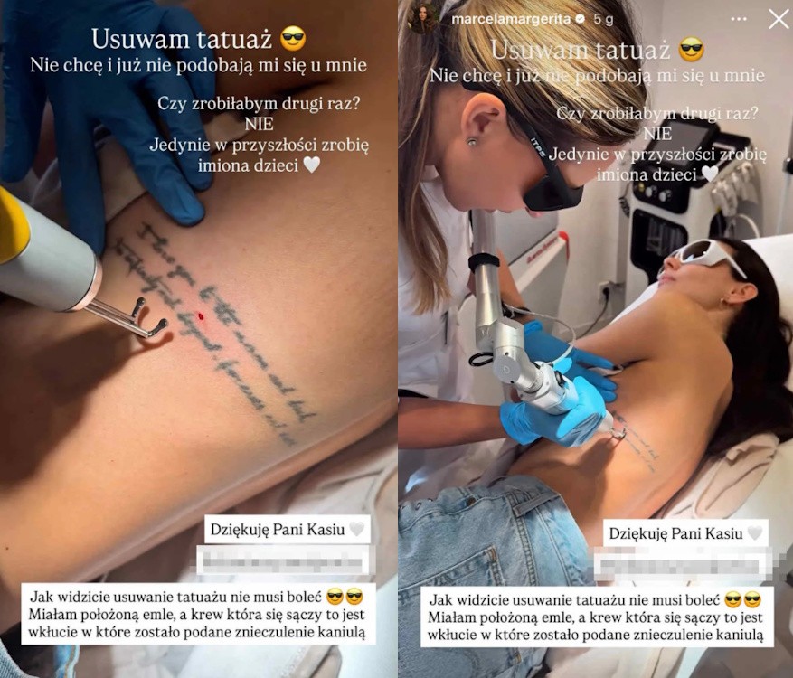 Marcela Leszczak podzieliła się relacją z usuwania tatuażu