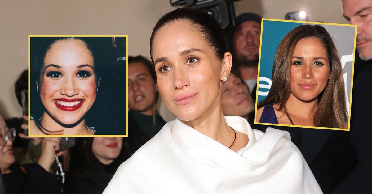 Twarz Meghan Markle mocno się zmieniła. "Przekroczenie linii akceptacji"