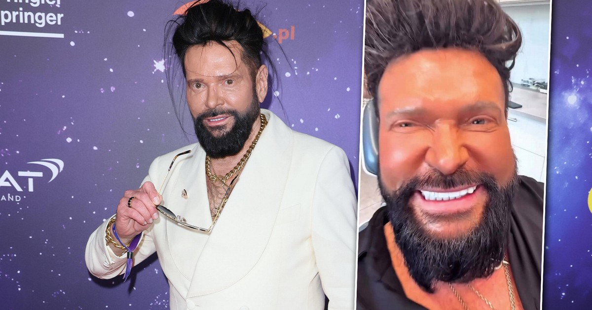 Krzysztof Rutkowski zafundował sobie nowe zęby. Fani mają mieszane opinie...