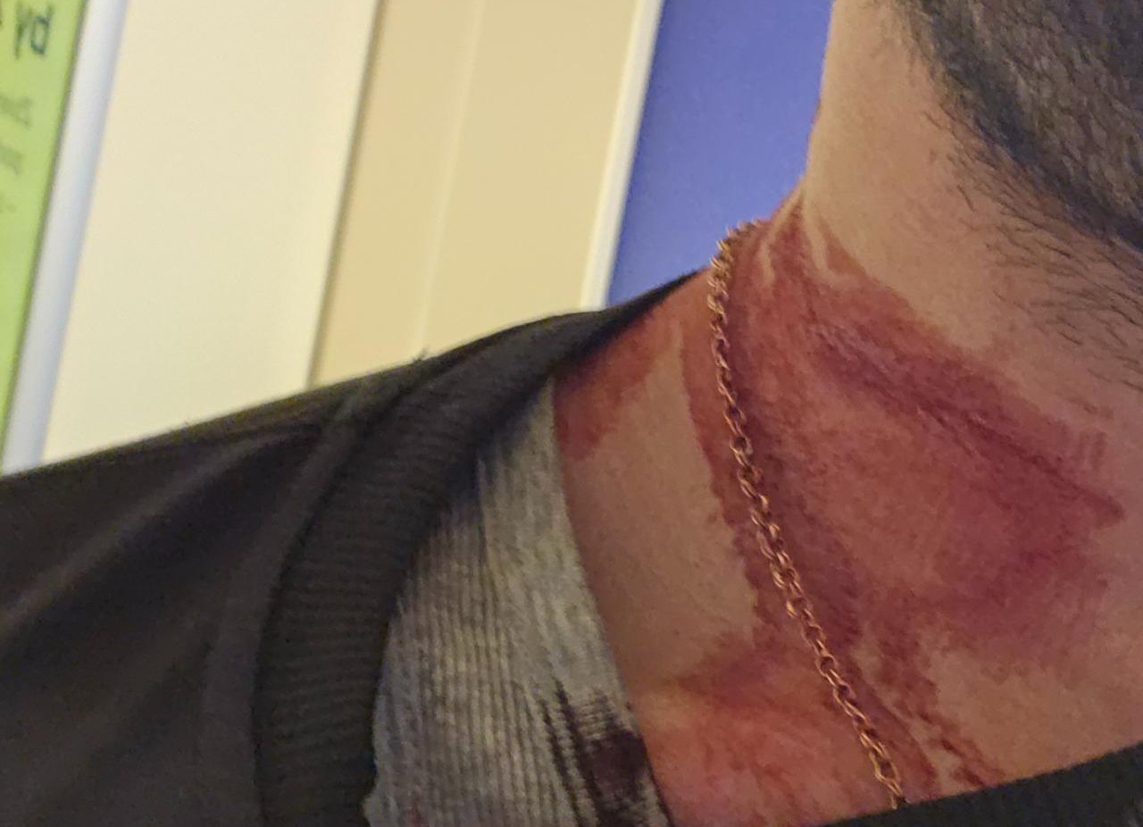 Mężczyzna z pojazdu uczestniczącego w śmiertelnym wypadku na Grunwaldzkiej zaatakował wcześniej taksówkarza na stacji benzynowej