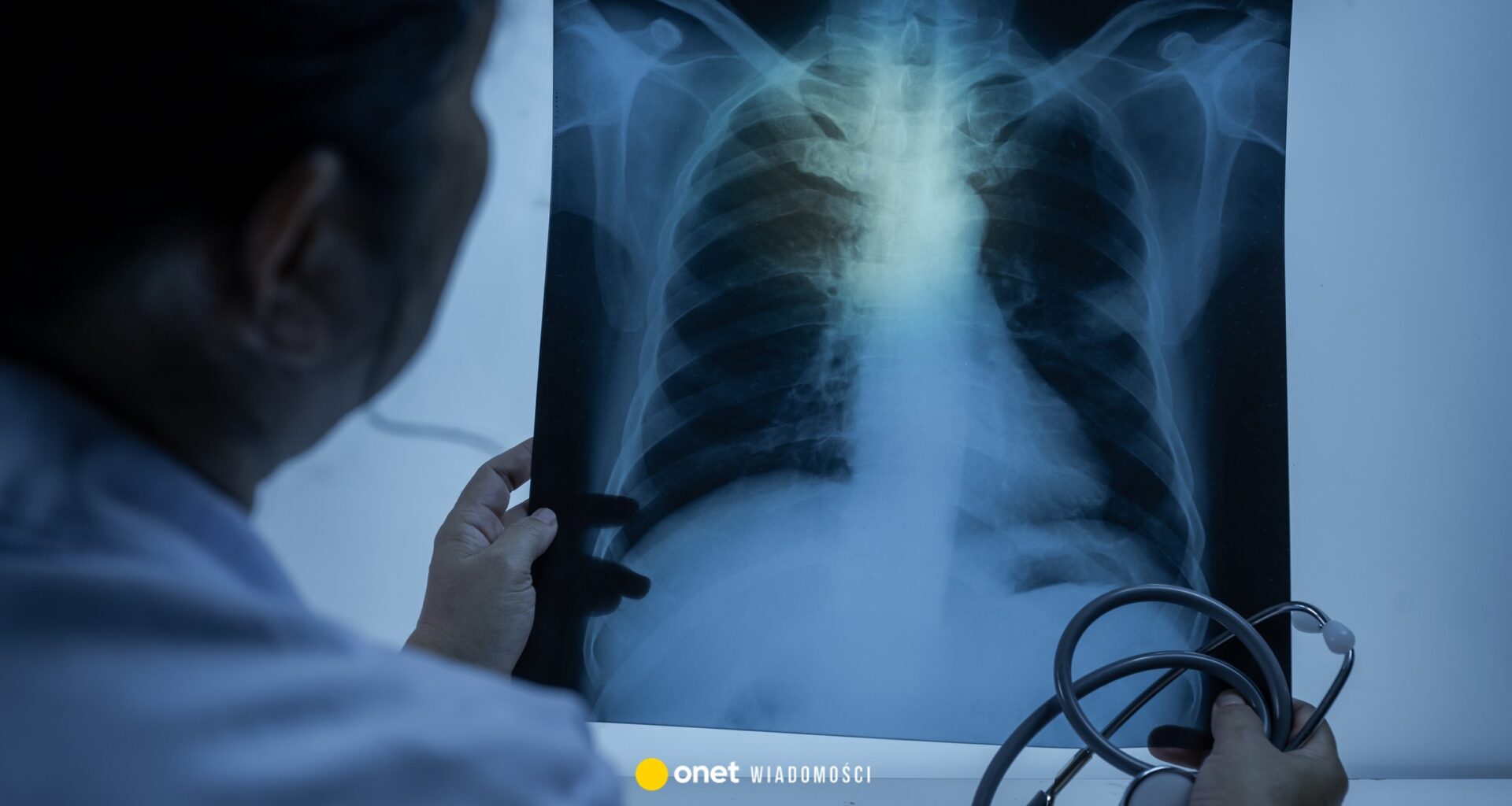 Nauczycielka z gruźlicą, uczniowie do diagnozy. Zakażała od dłuższego czasu