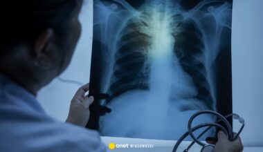 Nauczycielka z gruźlicą, uczniowie do diagnozy. Zakażała od dłuższego czasu