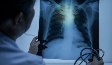 Nauczycielka z gruźlicą, uczniowie do diagnozy. Zakażała od dłuższego czasu