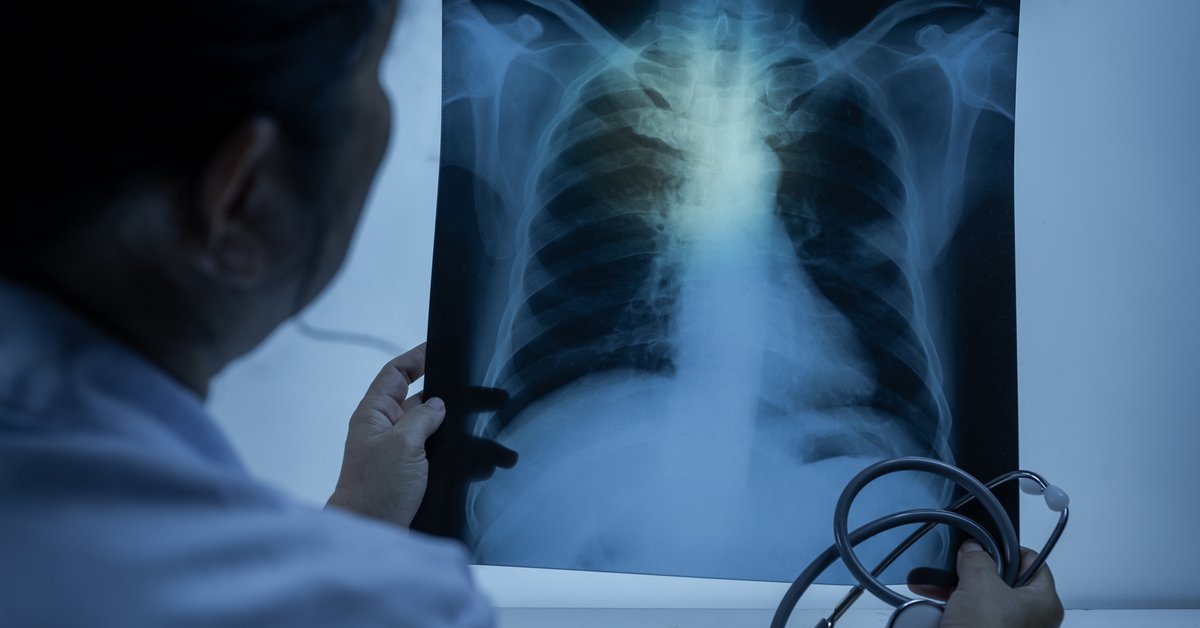 Nauczycielka z gruźlicą, uczniowie do diagnozy. Zakażała od dłuższego czasu