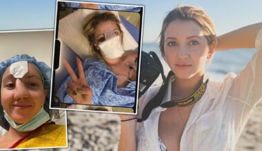 Pies odgryzł jej nos. Lekarze zrobili nowy z fragmentu czoła