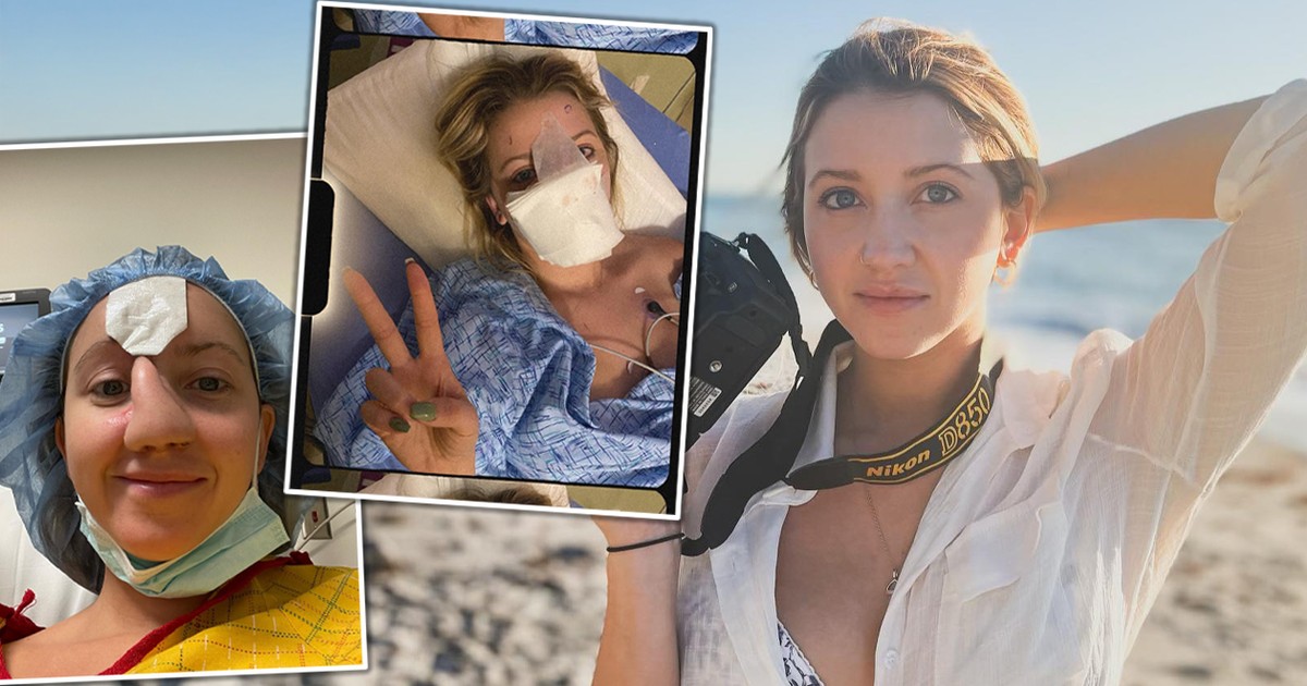 Pies odgryzł jej nos. Lekarze zrobili nowy z fragmentu czoła