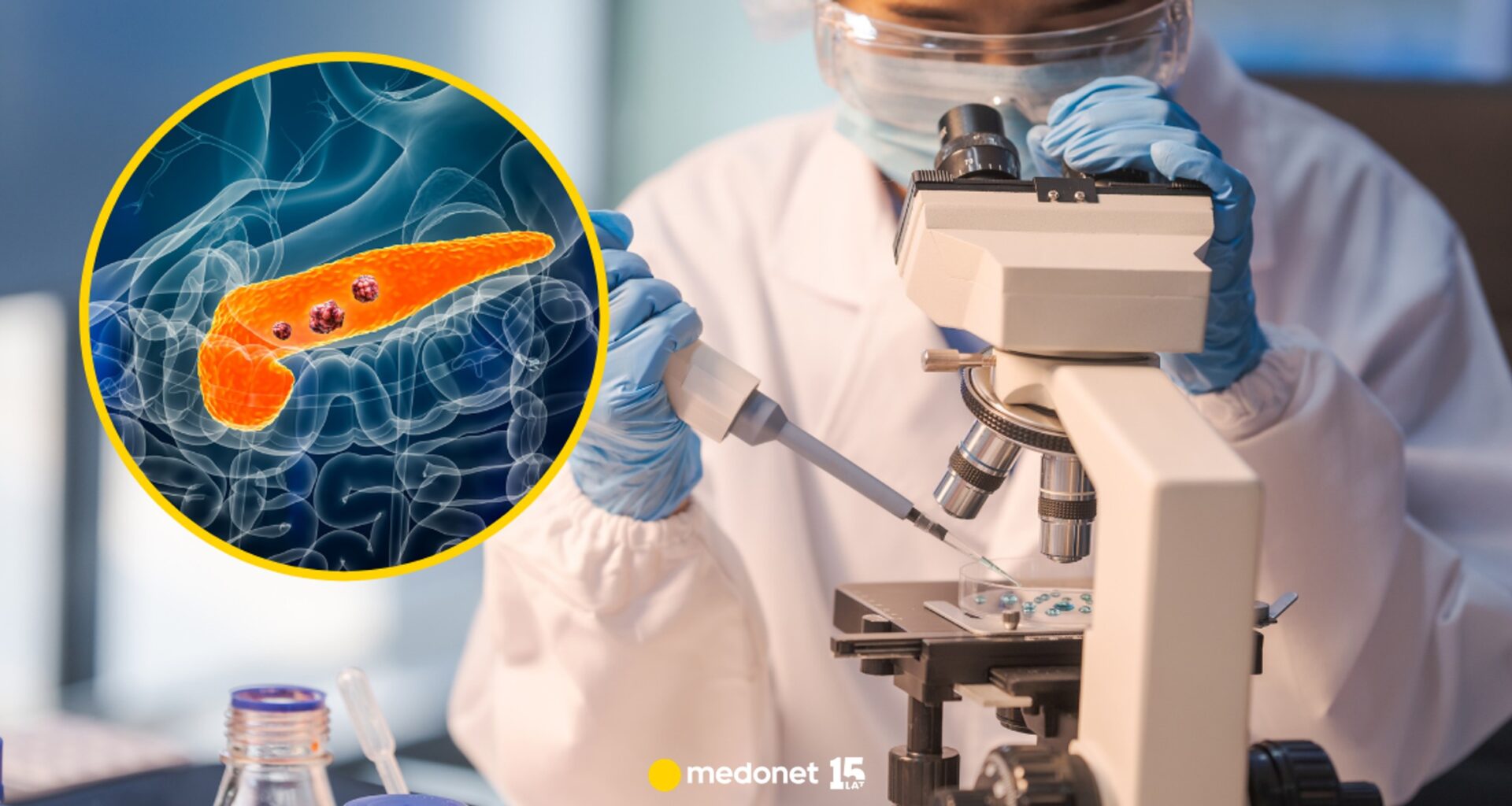 Przełom. Skuteczny lek na raka trzustki niebawem trafi do obrotu w USA