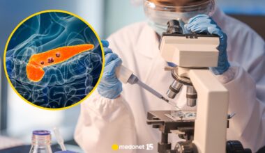 Przełom. Skuteczny lek na raka trzustki niebawem trafi do obrotu w USA