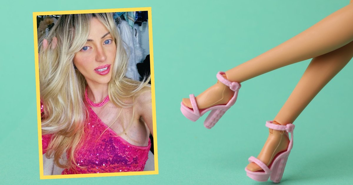 "Żywa Barbie" zmarła w wieku 31 lat. Wydała na operacje ponad 200 tys. zł