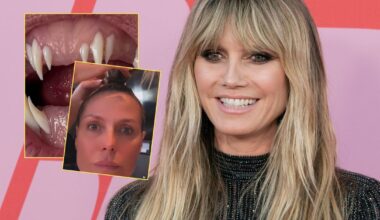 Heidi Klum już rozpoczęła przygotowania do Halloween. Pokazała przerażające zęby