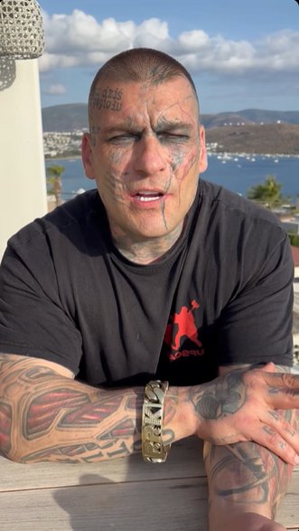 Popek nie ma już złotych zębów