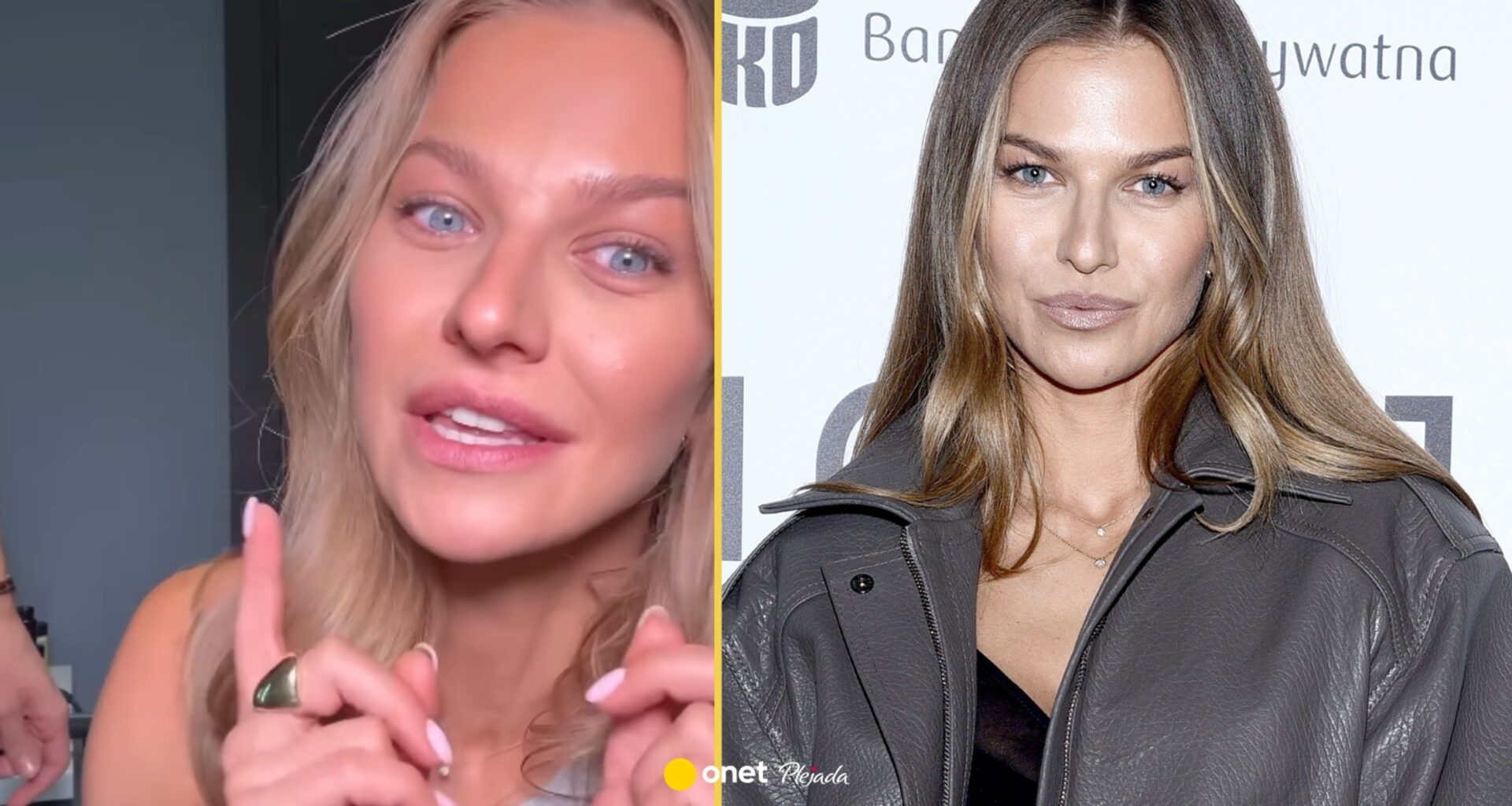 Anna Lewandowska ujawnia, czy zrobiła sobie usta. "A jednak"