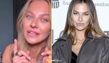 Anna Lewandowska ujawnia, czy zrobiła sobie usta. "A jednak"