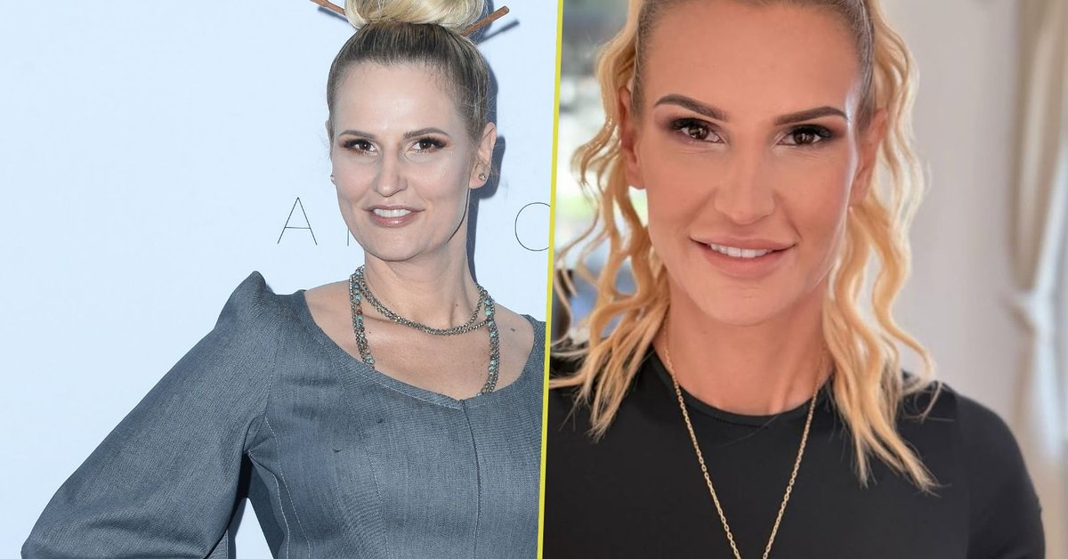 Dominika Tajner zamknęła usta hejterom. Zdradziła, z jakich zabiegów medycyny estetycznej korzystała