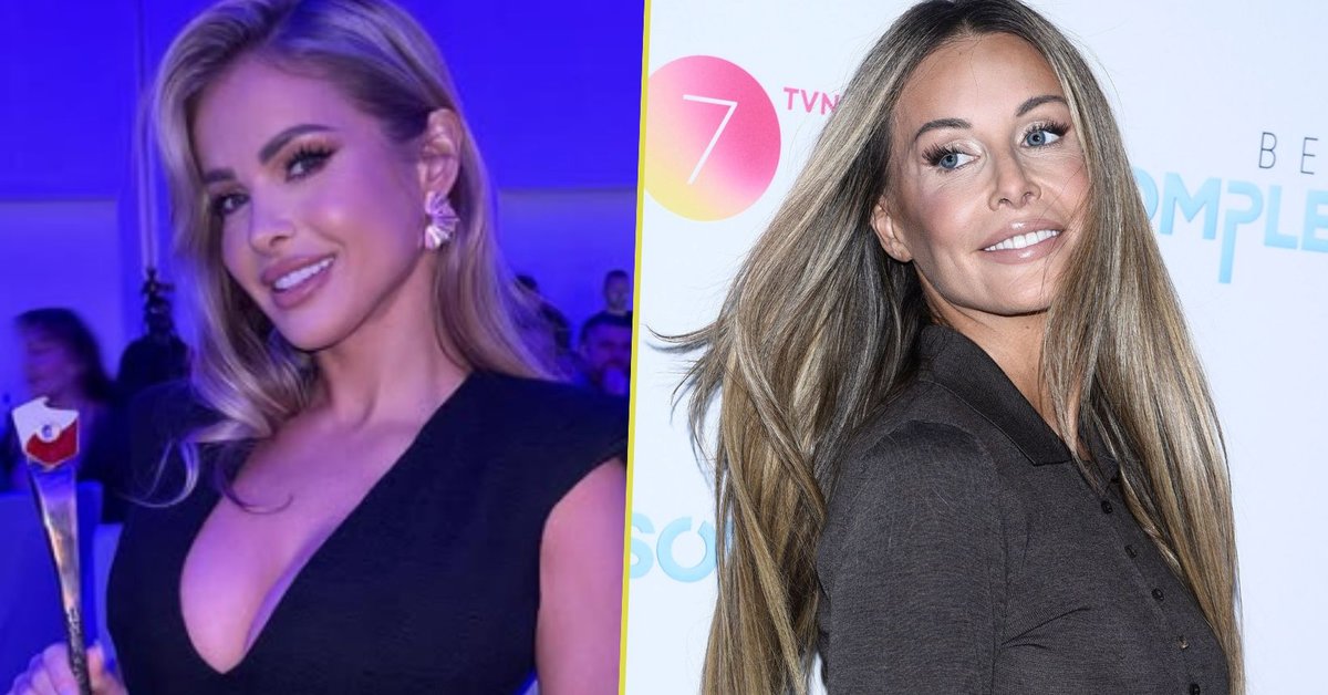 Paula Tumala oceniła operacje plastyczne Małgorzaty Rozenek-Majdan. "Wystarczy o siebie zadbać" - Onet