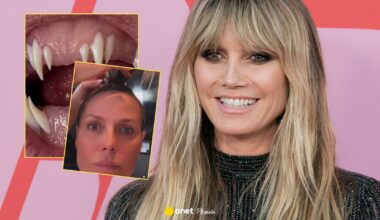 Heidi Klum już rozpoczęła przygotowania do Halloween. Pokazała przerażające zęby