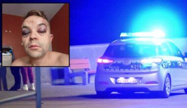 Brutalne pobicie w Gdyni na tle rasowym. Napastnik zaatakował też miejskiego radnego. "Jesteś Polakiem?"