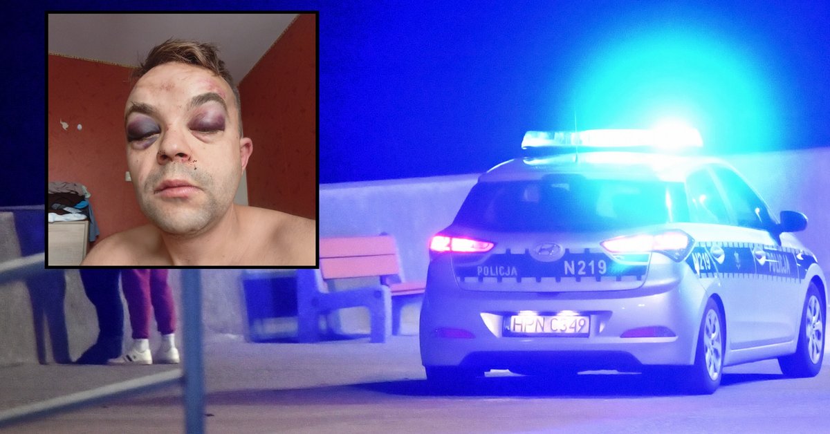 Brutalne pobicie w Gdyni na tle rasowym. Napastnik zaatakował też miejskiego radnego. "Jesteś Polakiem?"