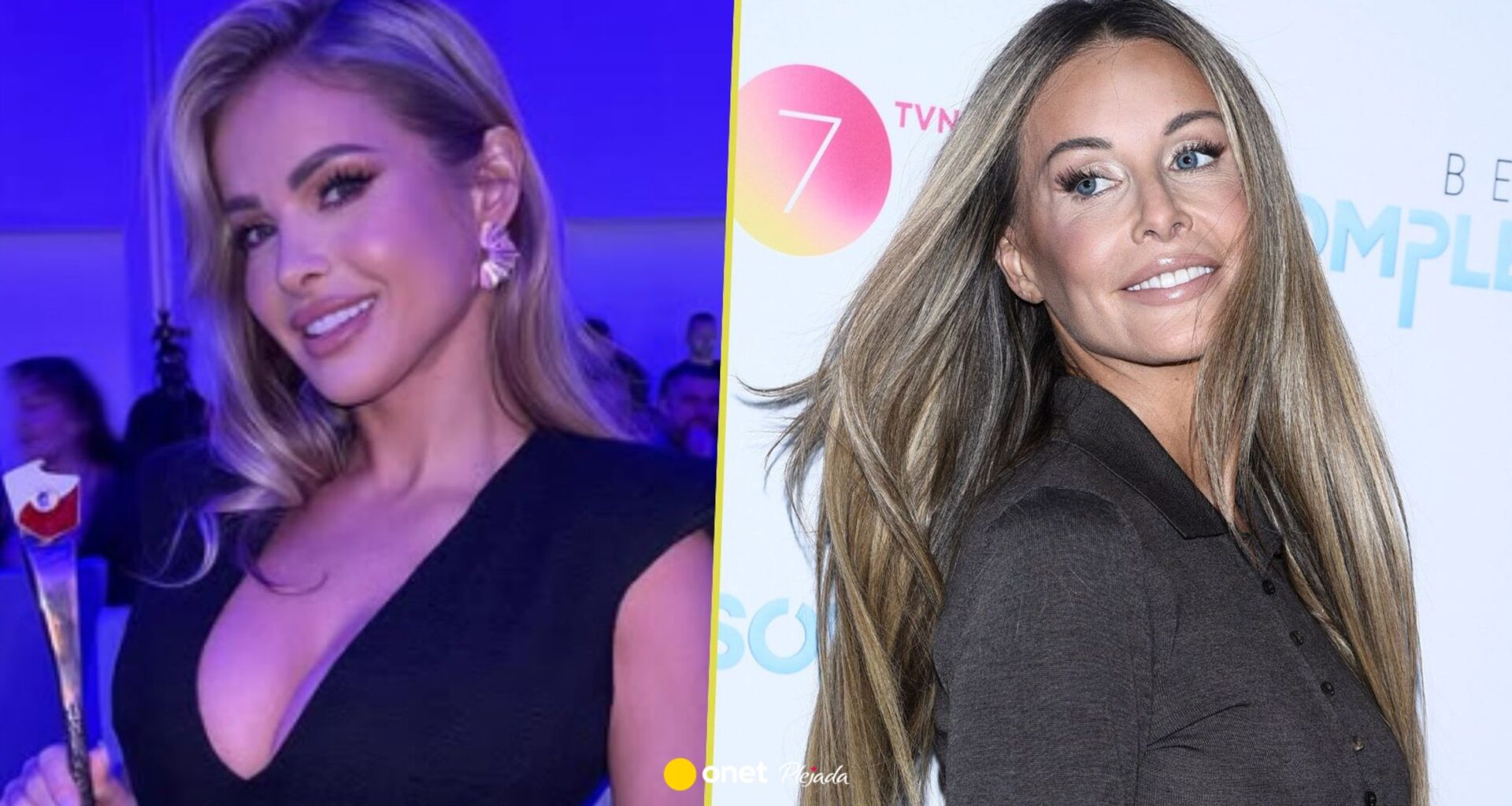 Paula Tumala o operacjach Małgorzaty Rozenek-Majdan. "Wystarczy zadbać o siebie"