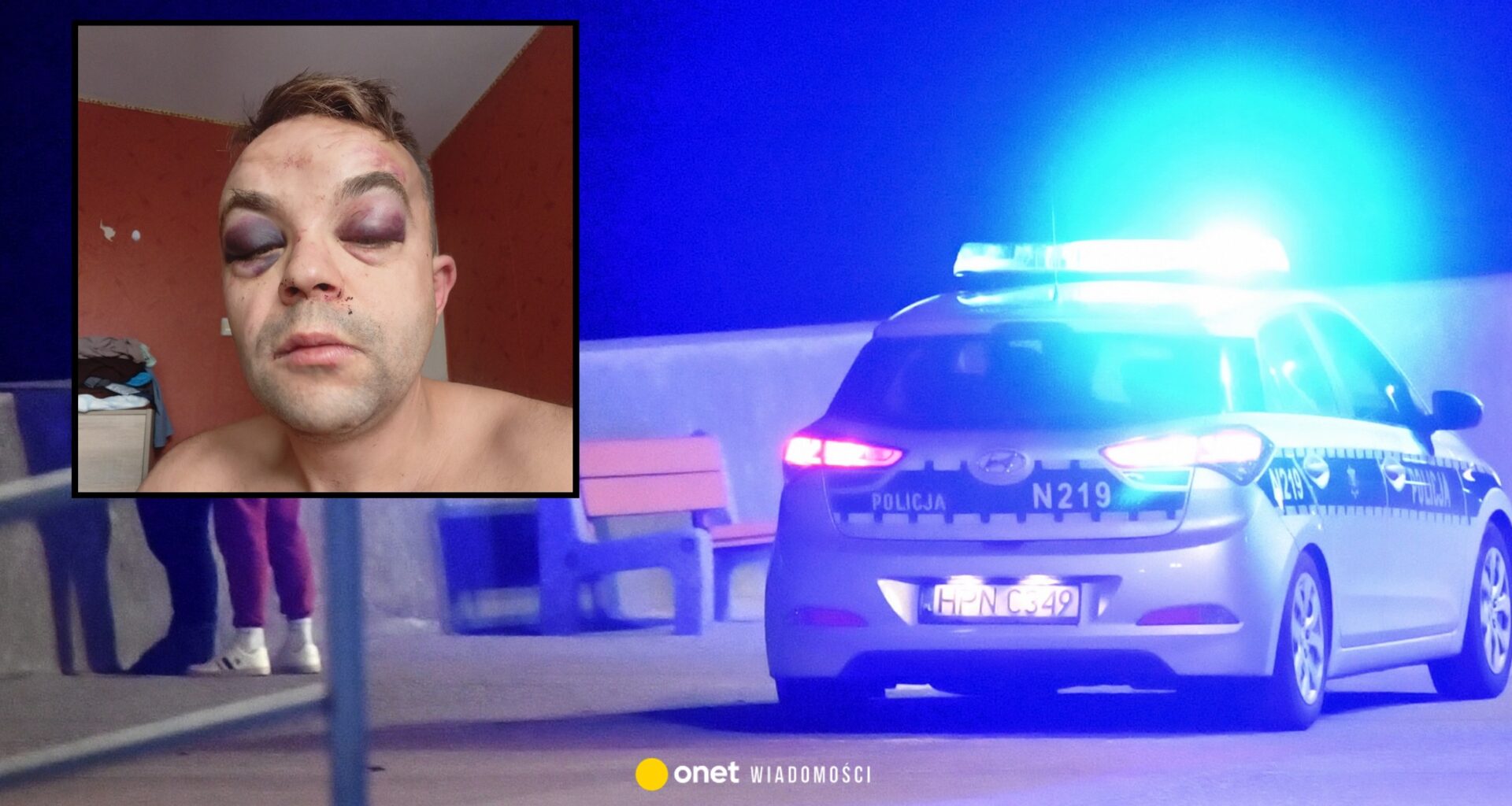 Brutalne pobicie w Gdyni na tle rasowym. Napastnik zaatakował miejskiego radnego. "Jesteś Polakiem?"