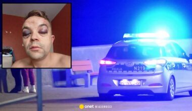 Brutalne pobicie w Gdyni na tle rasowym. Napastnik zaatakował miejskiego radnego. "Jesteś Polakiem?"
