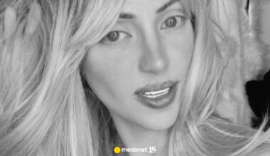 "Ludzka Barbie" nie żyje. 31-latka przeszła serię operacji plastycznych