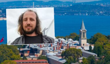 Tragiczny finał przeszczepu włosów w Turcji