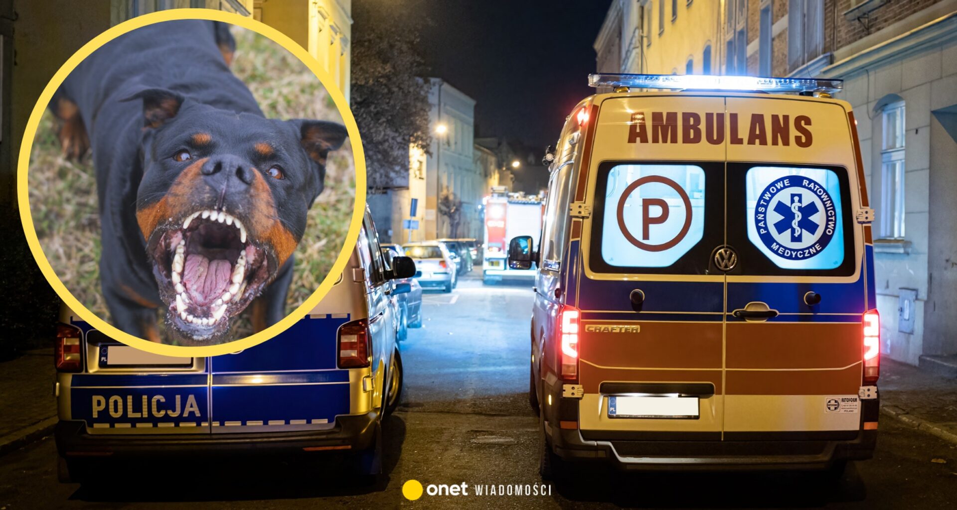 Agresywny pies zaatakował kobietę z dzieckiem w wózku. "Traciła dużo krwi"