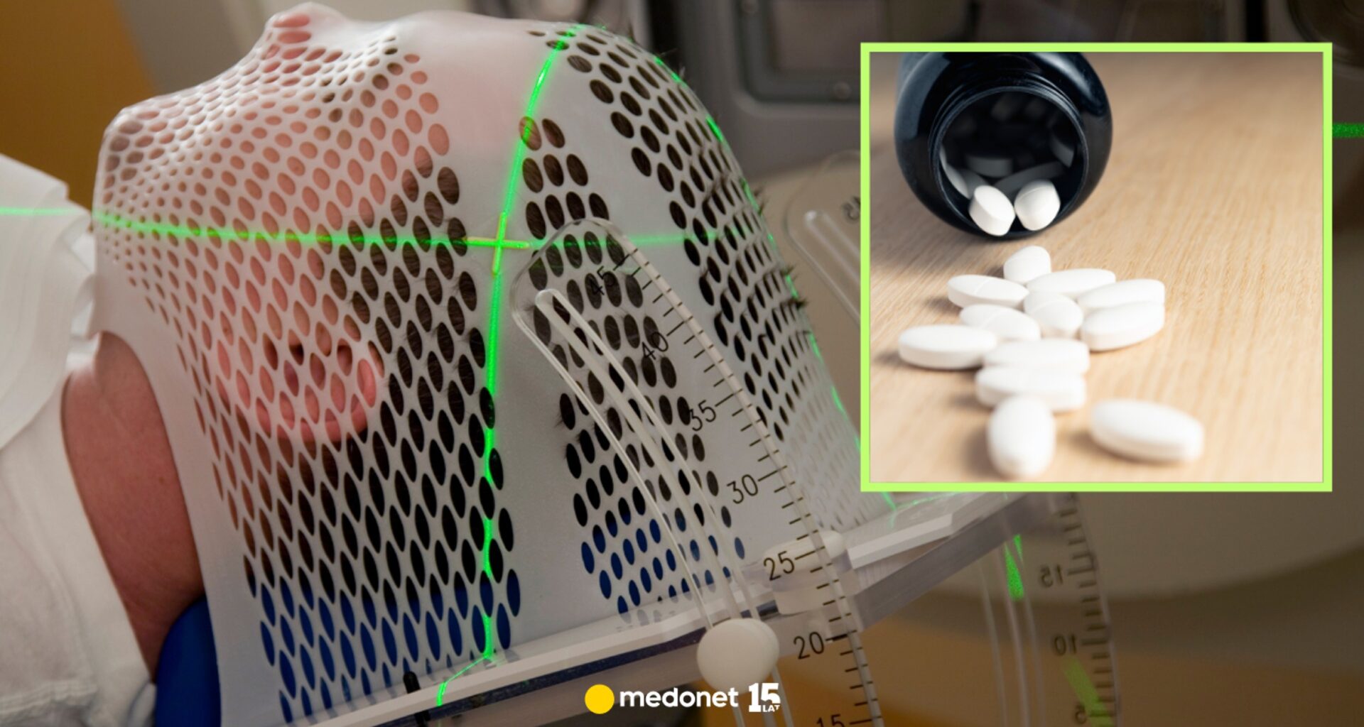 Znany lek na nadciśnienie spowalnia raka. Przełom w walce z guzami mózgu?