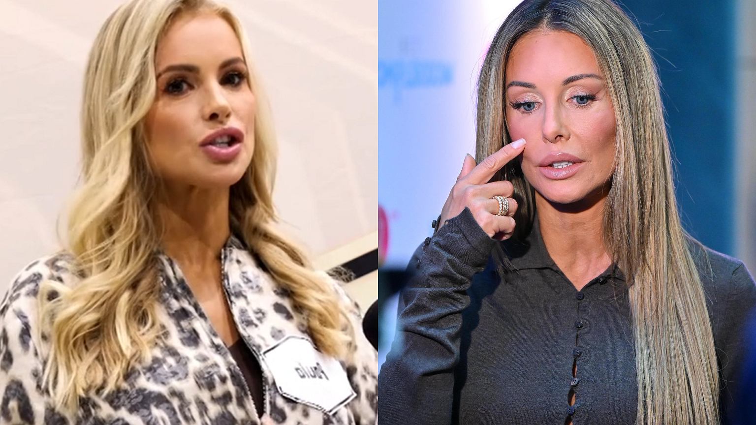 Tumala zjad³a zêby na medycynie estetycznej. Spojrza³a na Rozenek: Wystarczy chcieæ